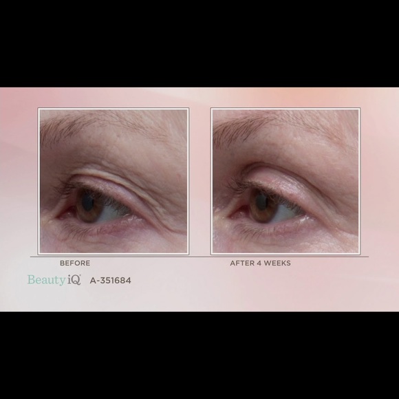 💗ELEMIS Peptide4 Eye Recovery Cream - Picture 9 of 10